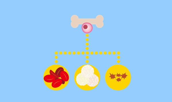 骨髄異形成症候群（MDS) - わかりやすい貧血の知識